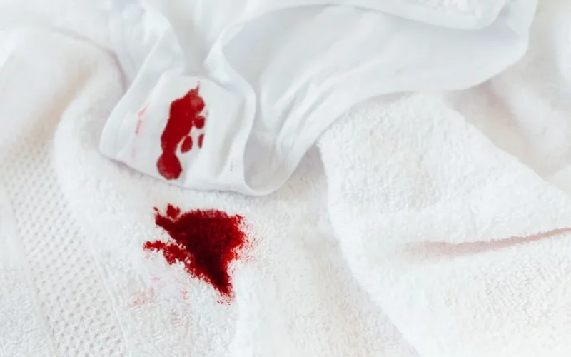 Close-up of white underwear and towel with visible menstrual blood stains.