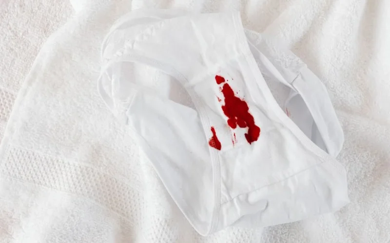 A close-up of white underwear with a menstrual stain on a white towel.